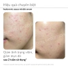 Serum kẽm Ekseption Hyaluronic ZnPCA 1% - Giảm mụn, kiềm dầu 75ml, giá ưu đãi 1.055.460 VNĐ 6