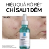 Serum La Roche-Posay Effaclar 30ml - Dưỡng chất 3 tác động giảm mụn, sebum, viêm - 1.059.000đ 7