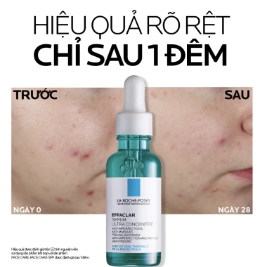 Serum La Roche-Posay Effaclar 30ml - Dưỡng chất 3 tác động giảm mụn, sebum, viêm - 1.059.000đ 7