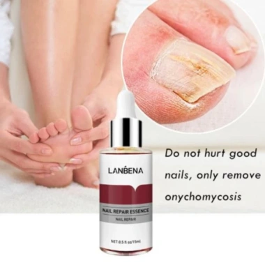 Serum Lanbena Phục Hồi Móng Tay Chân Chống Nấm - Nuôi Dưỡng Tái Tạo Móng, Giá 56.000đ