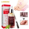 Serum Lanbena Phục Hồi Móng Tay Chân Chống Nấm - Nuôi Dưỡng Tái Tạo Móng, Giá 56.000đ 2