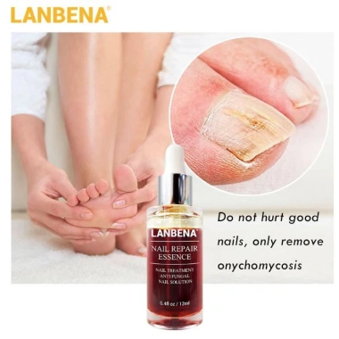 Serum Lanbena Phục Hồi Móng Tay Chân Chống Nấm - Nuôi Dưỡng Tái Tạo Móng, Giá 56.000đ