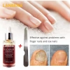 Serum Lanbena Phục Hồi Móng Tay Chân Chống Nấm - Nuôi Dưỡng Tái Tạo Móng, Giá 56.000đ 4