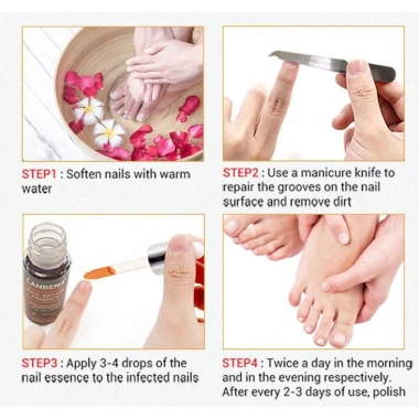 Serum Lanbena Phục Hồi Móng Tay Chân Chống Nấm - Nuôi Dưỡng Tái Tạo Móng, Giá 56.000đ