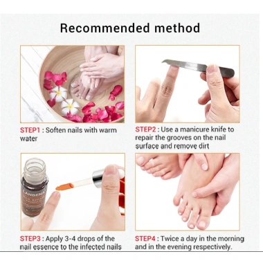 Serum Lanbena Phục Hồi Móng Tay Chân Chống Nấm - Nuôi Dưỡng Tái Tạo Móng, Giá 56.000đ