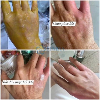 Serum Lurcinn Bio Centa Tế Bào Gốc Tái Tạo Cấp ẩm Phục Hồi Da Mỏng Yếu 15g Giá 629.000 VND 9