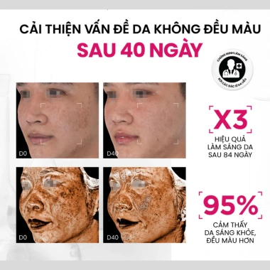 Serum MD CARE Brightenyl 30ml - Sáng da toàn diện, thế hệ mới, giảm giá 339.300₫ 3 Serum MD CARE Brightenyl 30ml - Sáng da toàn diện, thế hệ mới, giảm giá 339.300₫ 3