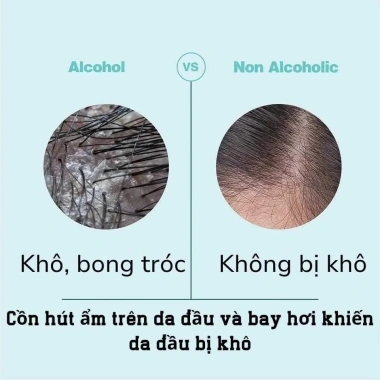 Serum Mọc Tóc Minoxidil 5% Redensyl và Finasteride Complex Không Cồn 60ml Giá 399.000₫ 2