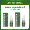 Serum Mụn Diếp Cá IGREEN 10ml - Giảm Mụn, Thâm, Se Khít Lỗ Chân Lông, Đều Màu Da, Tặng Bông Rửa Mặt - 169.000đ
