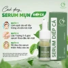Serum Mụn Diếp Cá IGREEN 10ml - Giảm Mụn, Thâm, Se Khít Lỗ Chân Lông, Đều Màu Da, Tặng Bông Rửa Mặt - 169.000đ 8