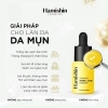 Serum Mụn Hasmi - Phục hồi da, ngăn mụn ẩn & li ti, giảm giá 179.000₫ 6