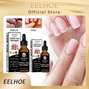 Serum Nấm Móng EELHOE Fungal Nail - Thảo Dược Dưỡng và Phục Hồi Mô Móng Hư, Giảm Giá Đặc Biệt 129k