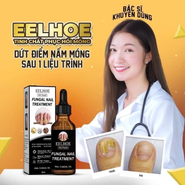 Serum Nấm Móng EELHOE Fungal Nail - Thảo Dược Dưỡng và Phục Hồi Mô Móng Hư, Giảm Giá Đặc Biệt 129k 3 Serum Nấm Móng EELHOE Fungal Nail - Thảo Dược Dưỡng và Phục Hồi Mô Móng Hư, Giảm Giá Đặc Biệt 129k 3