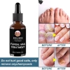 Serum Nấm Móng EELHOE Fungal Nail - Thảo Dược Dưỡng và Phục Hồi Mô Móng Hư, Giảm Giá Đặc Biệt 129k 4
