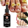 Serum Nấm Móng EELHOE Fungal Nail - Thảo Dược Dưỡng và Phục Hồi Mô Móng Hư, Giảm Giá Đặc Biệt 129k 5