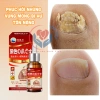 Serum Nấm Móng Nhật Bản Kannedo 30ml - Kháng Khuẩn, Giảm Nấm, Phục Hồi & Dưỡng Móng Khỏe 5