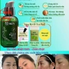 Serum Nhân Sâm MQ SKIN - Tái tạo da, loại bỏ mụn nám, nhang, chính hãng, 209.000đ