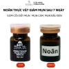 Serum Noãn Thực Vật MH Beauty Spa - Giảm Mụn, Gom Cồi, Kiềm Dầu, Phục Hồi Da - 65k