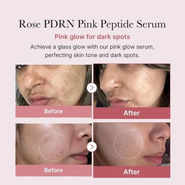 Serum Peptide Medicube PDRN 30ml Kích ứng thấp, Điểm tối, Kính phát sáng, Vitamin C, Da sáng, 190.850₫