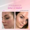 Serum Phục Hồi Tolpa CHANNY 30ml Giảm viêm mụn, làm dịu kích ứng, tăng đàn hồi da 445.000₫ 3