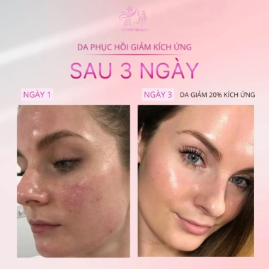 Serum Phục Hồi Tolpa CHANNY 30ml Giảm viêm mụn, làm dịu kích ứng, tăng đàn hồi da 445.000₫