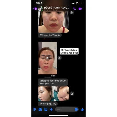 Serum Siêu Phục Hồi - Dưỡng ẩm sâu, làm sáng da, giảm nếp nhăn, giảm thâm, giá ưu đãi 684.000₫