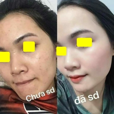 Serum Sữa Messo Trắng Da, Căng Bóng, Trẻ Hoá, Chống Lão Hoá - 51,000 VND 6