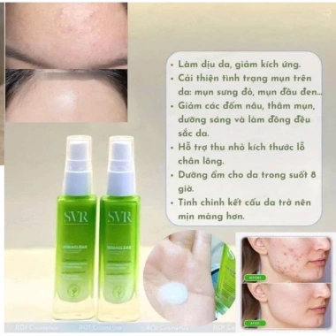 Serum SV R Sebialear Hyaluronic Acid + Vitamin B3 – Căng Bóng, Phục Hồi, Giảm Mụn