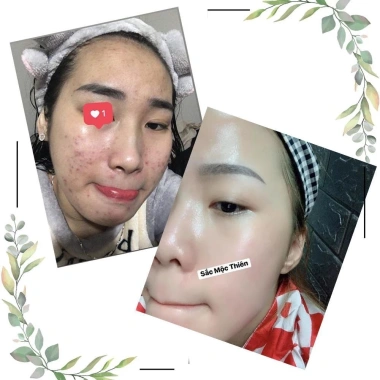 Serum Tinh Chất Giúp Tái Tạo Cao Cấp Sắc Mộc Thiên 30ml Trẻ Hóa Da, Giá 210.000₫ 3 Serum Tinh Chất Giúp Tái Tạo Cao Cấp Sắc Mộc Thiên 30ml Trẻ Hóa Da, Giá 210.000₫ 3