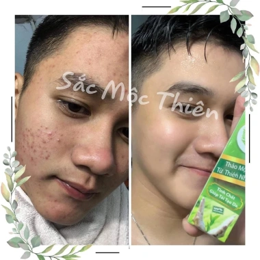 Serum Tinh Chất Giúp Tái Tạo Cao Cấp Sắc Mộc Thiên 30ml Trẻ Hóa Da, Giá 210.000₫