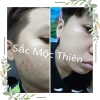 Serum Tinh Chất Giúp Tái Tạo Cao Cấp Sắc Mộc Thiên 30ml Trẻ Hóa Da, Giá 210.000₫ 5