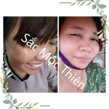 Serum Tinh Chất Giúp Tái Tạo Cao Cấp Sắc Mộc Thiên 30ml Trẻ Hóa Da, Giá 210.000₫