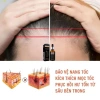 Serum Tinh Chất Thảo Dược Giảm Gàu Ngứa, Kích Thích Mọc Tóc, Bảo Tóc Chắc Khoẻ - 62.000đ 7