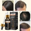 Serum Tinh Chất Thảo Dược Giảm Gàu Ngứa, Kích Thích Mọc Tóc, Bảo Tóc Chắc Khoẻ - 62.000đ 8