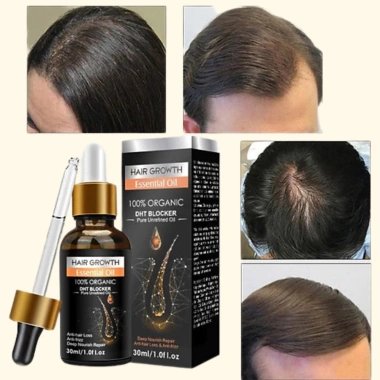 Serum Tinh Chất Thảo Dược Giảm Gàu Ngứa, Kích Thích Mọc Tóc, Bảo Tóc Chắc Khoẻ - 62.000đ