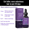Serum ủ tóc kích thích mọc dày, siêu dưỡng ẩm, ngăn gãy rụng - Dành cho tóc khô xơ, hư tổn nặng, giảm 19% 4