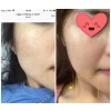 Serum Vitamin C Balea 30ml Dưỡng Trắng Da, Mờ Thâm Nám - Giảm Giá 290.000₫ 9
