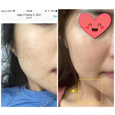 Serum Vitamin C Balea 30ml Dưỡng Trắng Da, Mờ Thâm Nám - Giảm Giá 290.000₫ 9