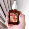 Serum Vitamin C DR ALTHEA 30ml Da Sáng Xóa Đốm Nâu Tàn Nhang Giá 261.800 2