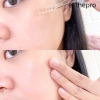 Serum Vitamin C Esthepro 561 100ml – Da sáng, mờ thâm nám, chống oxy hoá, chỉ 299.000₫ 6