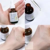 Serum Vitamin C Keana VC10 & VC15 Sáng da, nhỏ lỗ chân lông, giảm bã nhờn 30ml 9