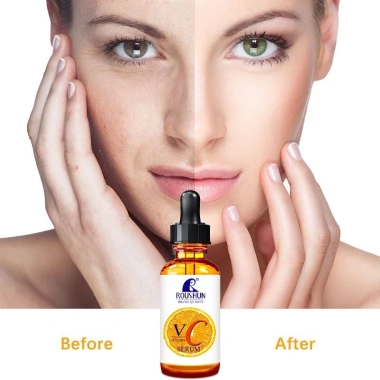 Serum Vitamin C tươi Roushun – Da trắng sáng, căng bóng, trẻ hoá – Chỉ 75.000đ