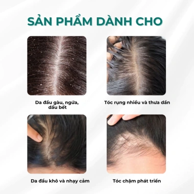 Set 2 lọ Serum Dưỡng Nang Tóc & Da Đầu Bio-Placental 30ml - 259.000, mọc tóc nhanh 3