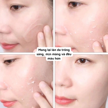Set 5-10 Gói Gel Tẩy Tế Bào Chết Ohui Clear Science Soft Peeling Da Sáng Mịn 1ml 22.500 VND