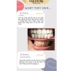 SET 7 GÓI Miếng dán trắng răng Crest 3D White - Răng trắng sáng, an toàn men răng, Chính Hãng 5