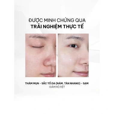 Set Kans Dưỡng Ẩm - Trắng Da Neige Blanc Giảm Thâm Mụn, Da Sáng Đều Màu, 1.439.000₫ 6