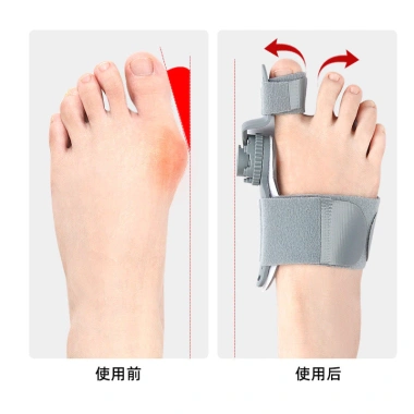 Shaper Ngón Cái Valgus 16FC Xương Chân Lớn Đùn Chồng Điều Chỉnh Xoay Ngày Đêm 2