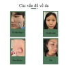 SHEEureka Chlorella Cleanser - Kiểm soát dầu, làm sạch sâu, tẩy tế bào chết, nhẹ nhàng da - 65.000₫ 4