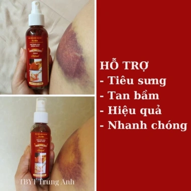 [Sỉ HCM] Dầu xoa bóp thảo dược 100ml - Giảm đau xương khớp, vai gáy, tiêu bầm, xịt xương khớp, giá 75k 3
