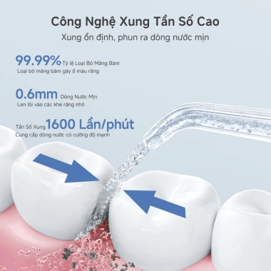 Simplus Pink Máy Tăm Nước 300ml 4 Chế Độ 4 Vòi Dễ Mang, Bảo Hành 1 Năm 1 Đổi 1 6 Simplus Pink Máy Tăm Nước 300ml 4 Chế Độ 4 Vòi Dễ Mang, Bảo Hành 1 Năm 1 Đổi 1 6